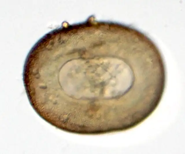 Arcella sp.