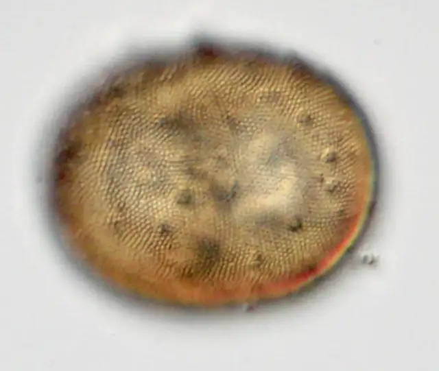 Arcella sp.