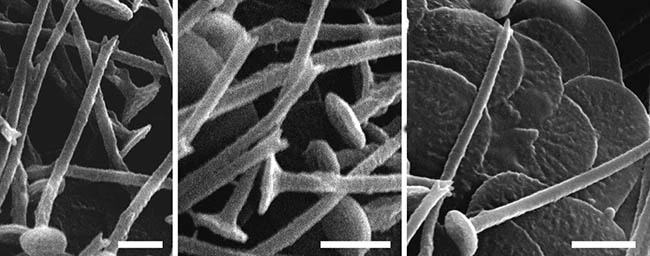 Acanthocystis elenazhivotovae