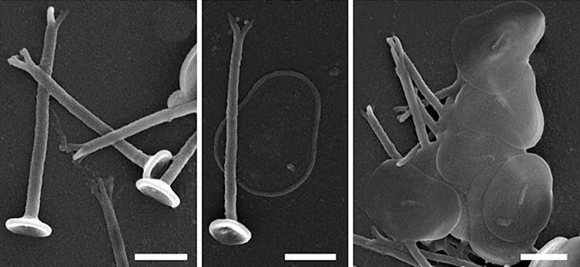 Acanthocystis mikrjukovi