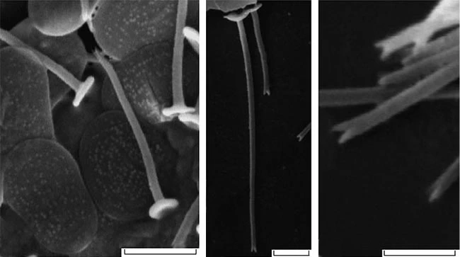 Acanthocystis olgashelestae