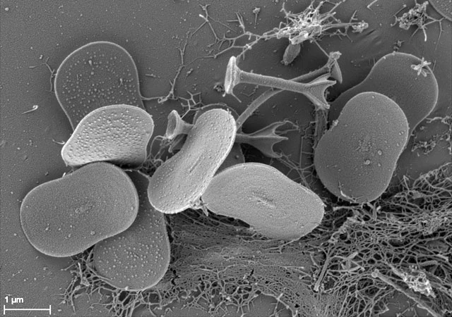 Acanthocystis pectinata