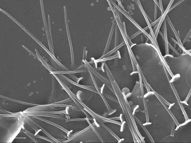 Acanthocystis myriospina