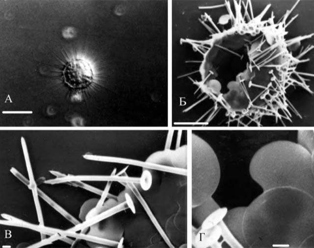 Acanthocystis wiasemskii