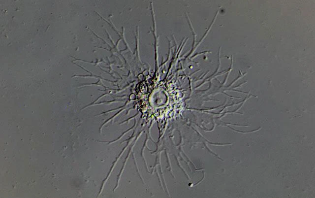 Actinocoma ramosa