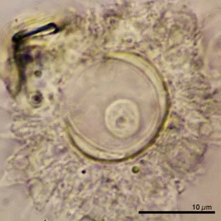 Actinocoma ramosa