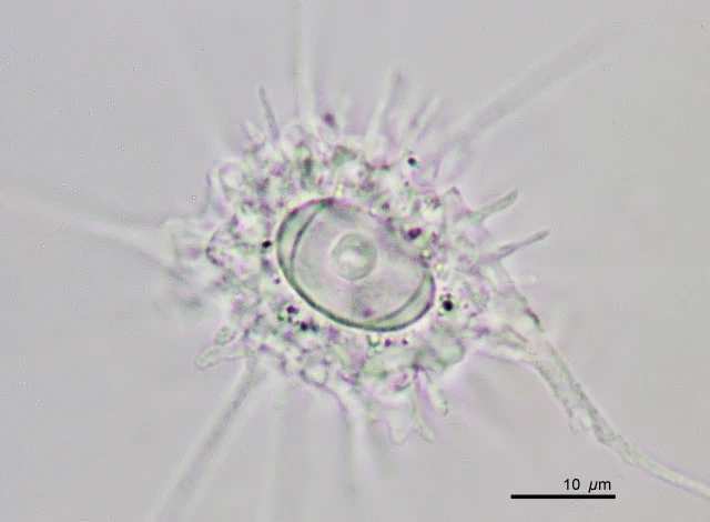 Actinocoma ramosa