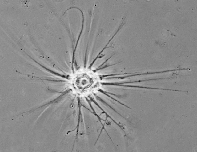 Actinocoma ramosa