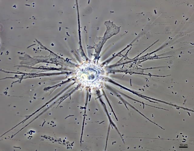 Actinocoma ramosa