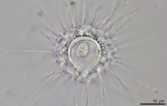 Actinocoma ramosa