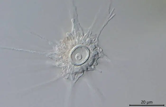 Actinocoma ramosa