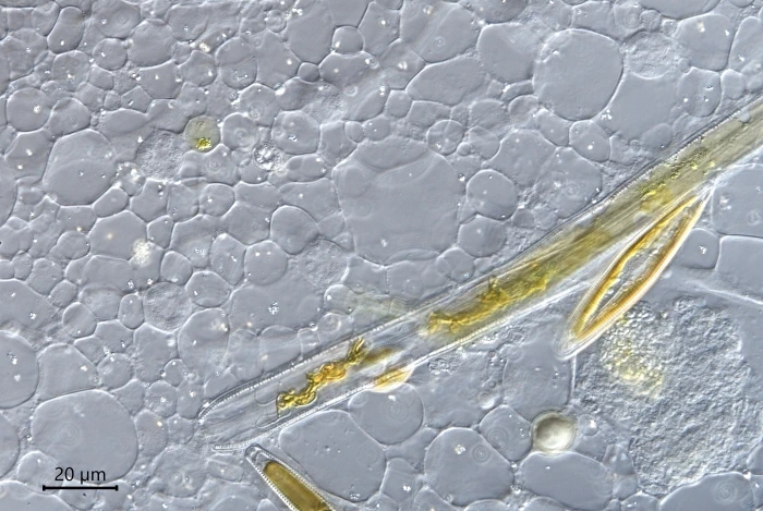 Actinosphaerium arachnoideum