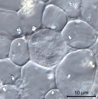 Actinosphaerium arachnoideum