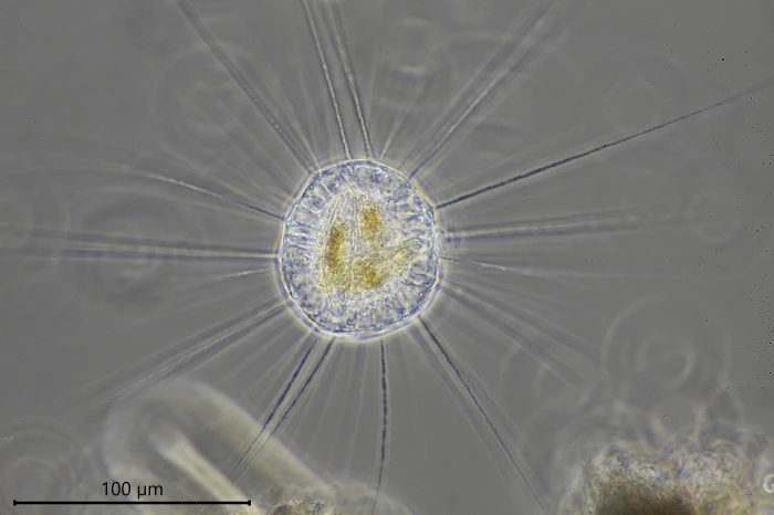 Actinosphaerium arachnoideum