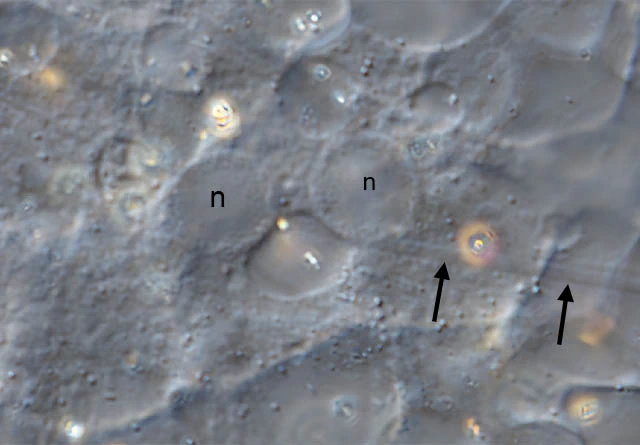 Actinosphaerium nucleofilum