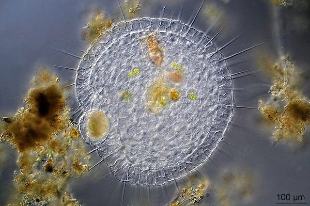 Actinosphaerium eichhornii