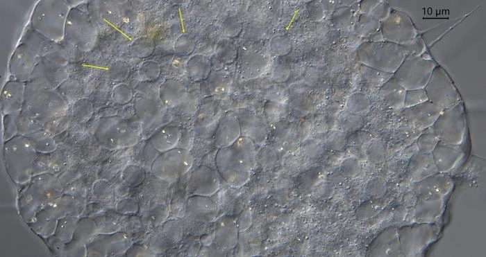 Actinosphaerium nucleofilum