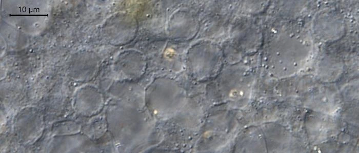 Actinosphaerium nucleofilum