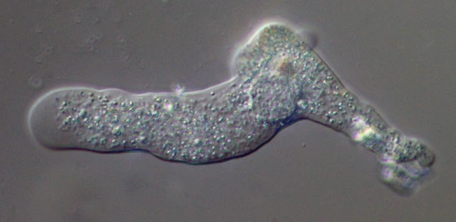 Amoeba leningradensis