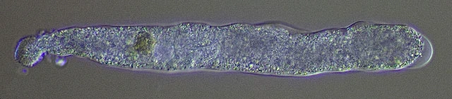 Amoeba leningradensis