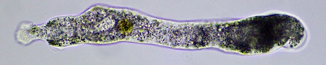 Amoeba leningradensis