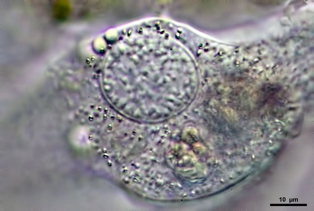 Amoeba leningradensis