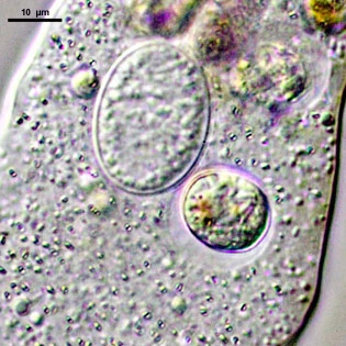 Amoeba leningradensis