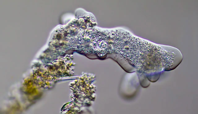 Amoeba leningradensis