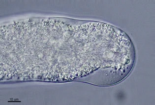 Amoeba leningradensis