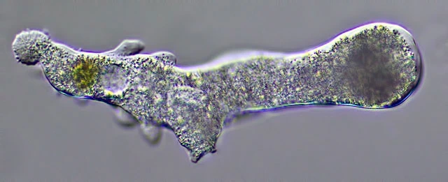 Amoeba leningradensis