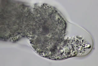 Amoeba leningradensis