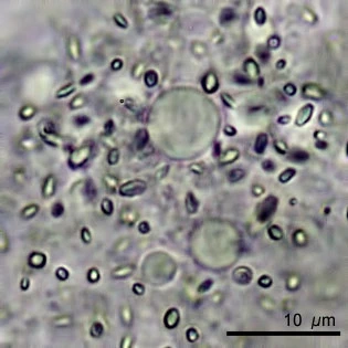 Amoeba leningradensis