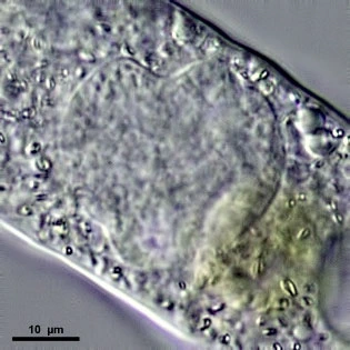 Amoeba leningradensis