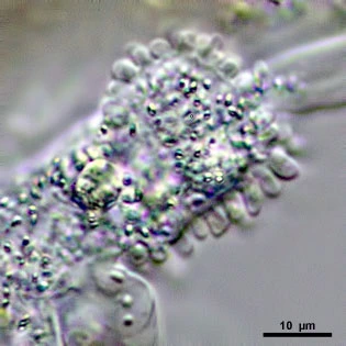 Amoeba leningradensis