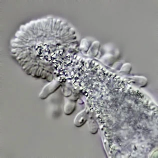 Amoeba leningradensis