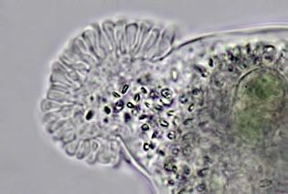 Amoeba leningradensis