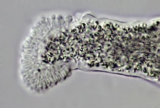 Amoeba leningradensis