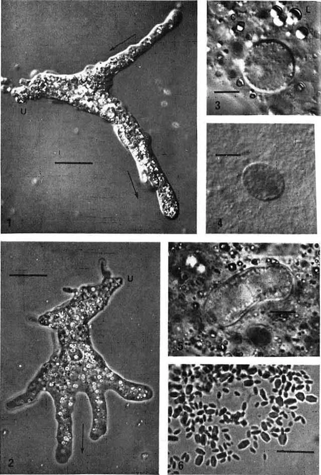 Amoeba leningradensis