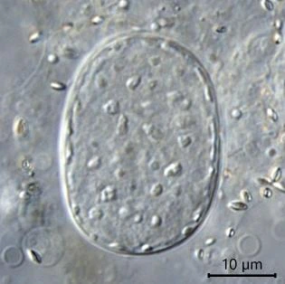 Amoeba proteus