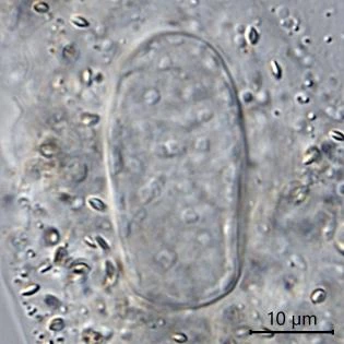Amoeba proteus