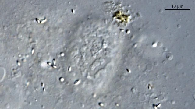 Amoeba proteus