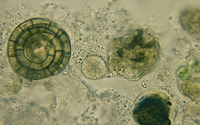 Zonomyxa violacea
