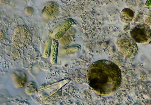 Zonomyxa violacea