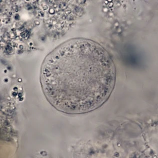 Zonomyxa violacea