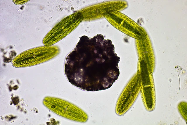 Zonomyxa violacea