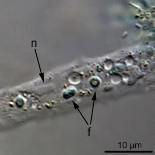 Arboramoeba reticulata