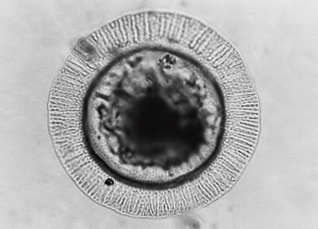 Arcella brasiliensis