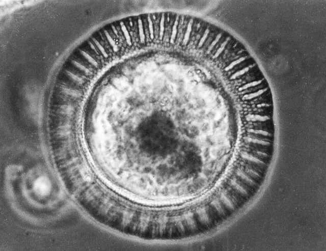 Arcella brasiliensis