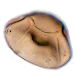 Arcella catinus