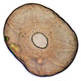 Arcella catinus